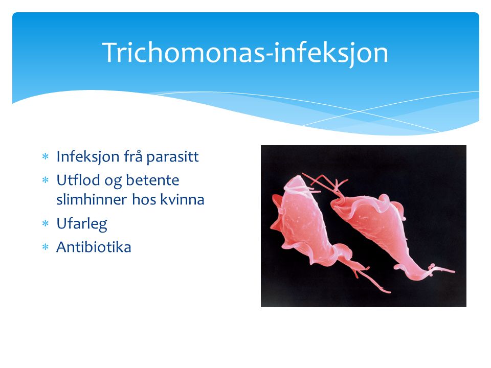 Trichomonas-infeksjon  Infeksjon frå parasitt  Utflod og betente slimhinner hos kvinna  Ufarleg  Antibiotika