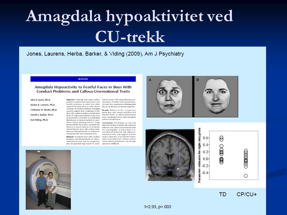 Amagdala hypoaktivitet ved CU-trekk