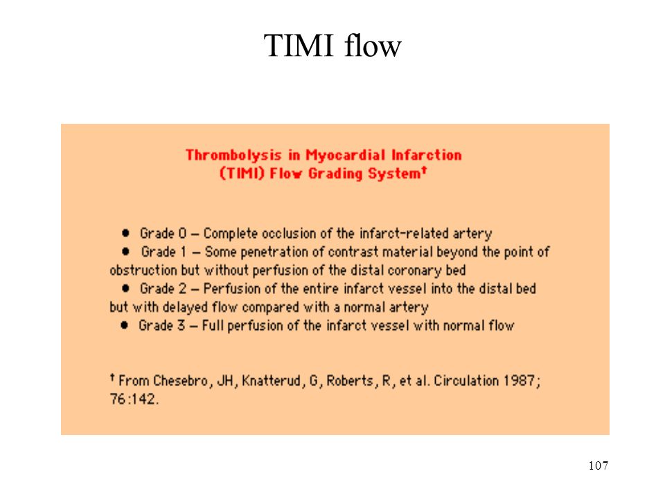 107 TIMI flow