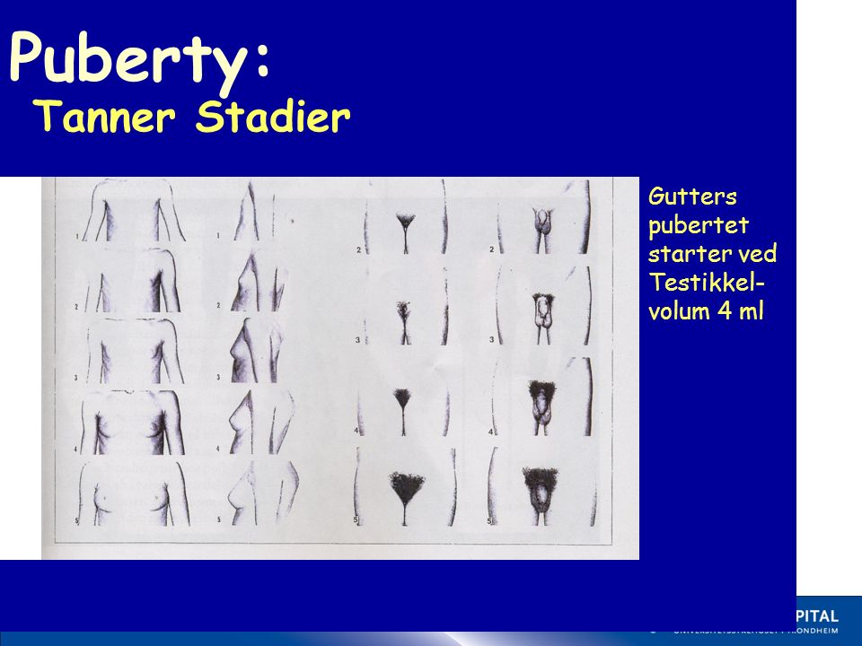 17 Puberty: Tanner Stadier Gutters pubertet starter ved Testikkel- volum 4 ml