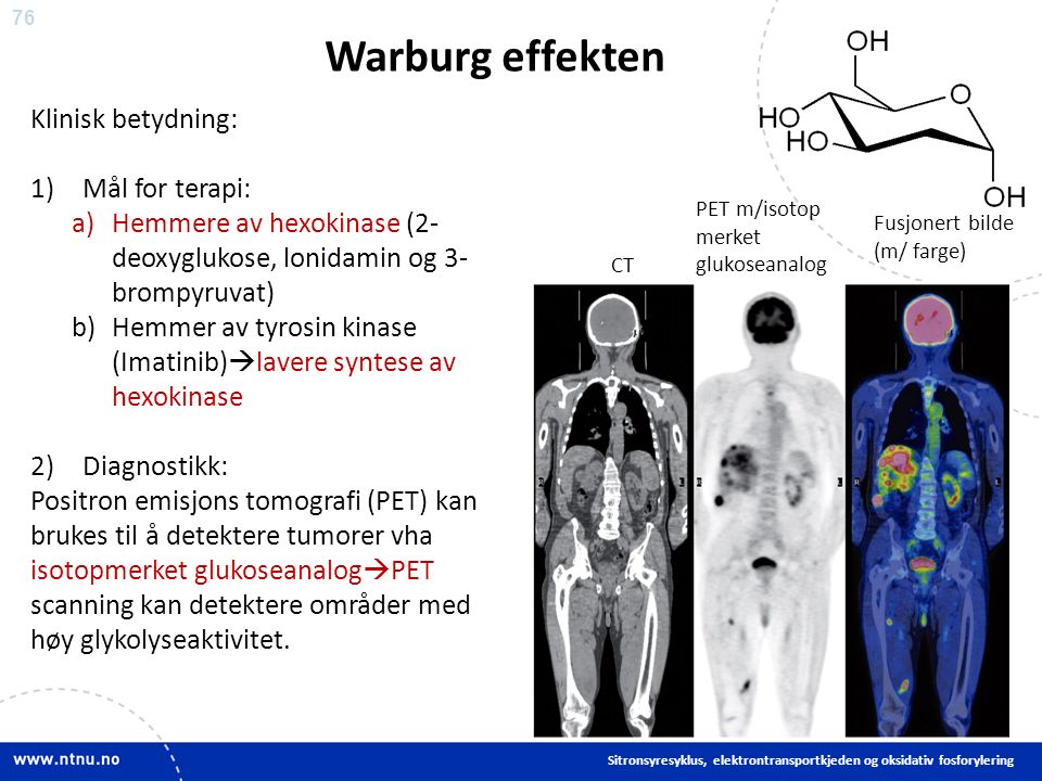 76 Warburg effekten Sitronsyresyklus, elektrontransportkjeden og oksidativ fosforylering Klinisk betydning: 1)Mål for terapi: a)Hemmere av hexokinase (2- deoxyglukose, lonidamin og 3- brompyruvat) b)Hemmer av tyrosin kinase (Imatinib)  lavere syntese av hexokinase 2)Diagnostikk: Positron emisjons tomografi (PET) kan brukes til å detektere tumorer vha isotopmerket glukoseanalog  PET scanning kan detektere områder med høy glykolyseaktivitet.